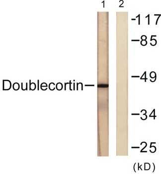 Doublecortin rabbit pAb