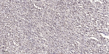 Doublecortin rabbit pAb