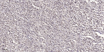 Doublecortin antibody