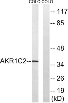 DD2 antibody