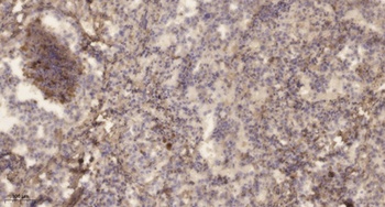 DD2 antibody