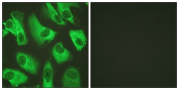 KIR5.1 antibody