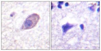 KIR5.1 antibody