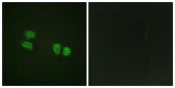 p68 RNA Helicase (phospho-Tyr593) antibody