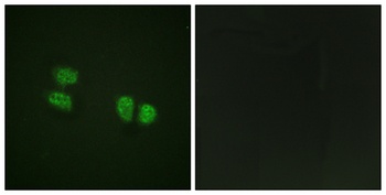 p68 RNA Helicase (phospho Tyr593) rabbit pAb