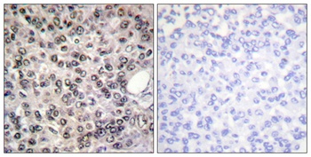 p68 RNA Helicase (phospho Tyr593) rabbit pAb