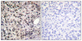 p68 RNA Helicase (phospho-Tyr593) antibody