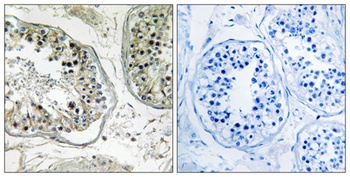 CHST13 antibody