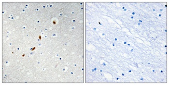 ZNF596 rabbit pAb Antibody