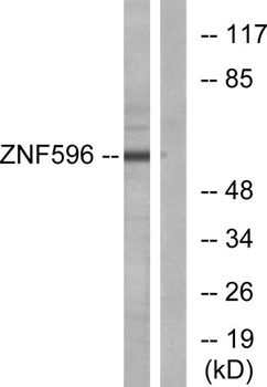 ZNF596 rabbit pAb Antibody