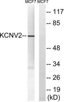 KV8.2 antibody