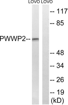 PWWP2B rabbit pAb