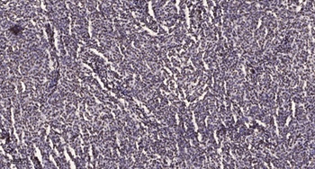 PWWP2B antibody