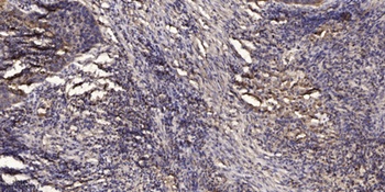 KCNG3 antibody