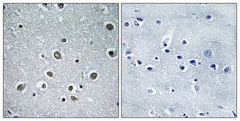 POLR3H antibody