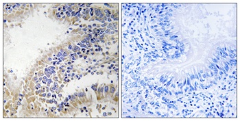 DHODH antibody