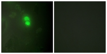 Dyskerin antibody