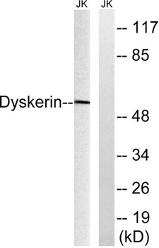 Dyskerin rabbit pAb