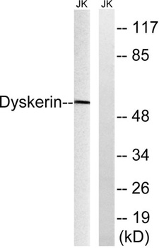 Dyskerin antibody