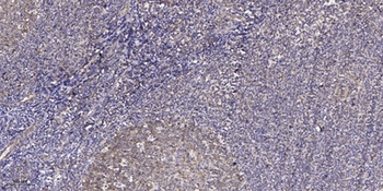 Dyskerin antibody