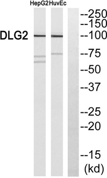 PSD-93 antibody