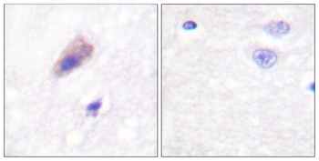 Dynamin I (phospho Ser774) rabbit pAb