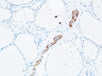 TdT antibody