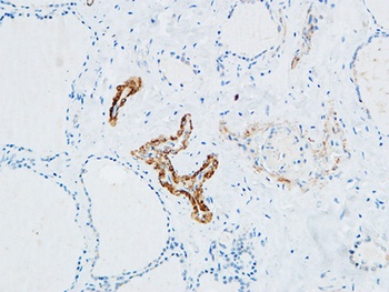 TdT antibody