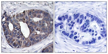 Dok-1 antibody