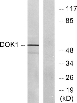 Dok-1 rabbit pAb