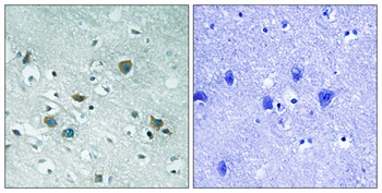 CRMP-2 (phospho Thr509) rabbit pAb