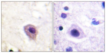 CRMP-2 (phospho Thr514) rabbit pAb