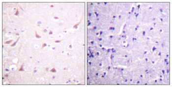CRMP-2 rabbit pAb