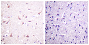 CRMP-2 antibody