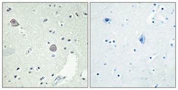 D1DR antibody