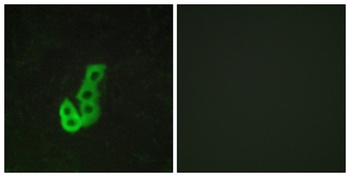 D1DR antibody