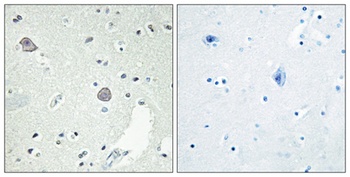 D1DR antibody