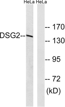 Desmoglein 2 antibody