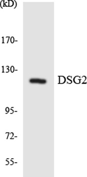 Desmoglein 2 antibody