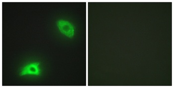 MKP-3 antibody