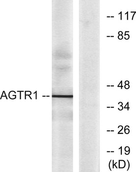 AT1 antibody