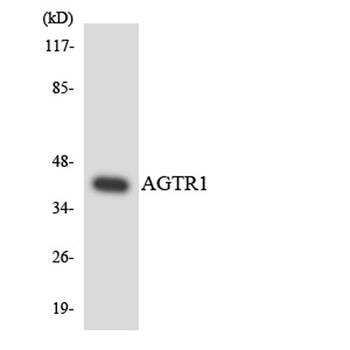 AT1 antibody