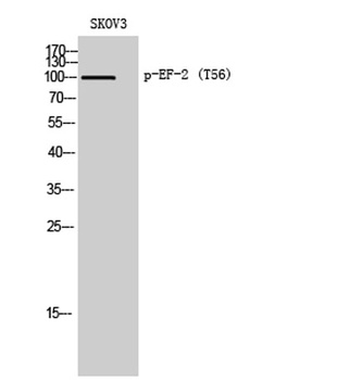 EF-2 (phospho Thr56) rabbit pAb