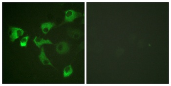 EF-2 (phospho-Thr56) antibody