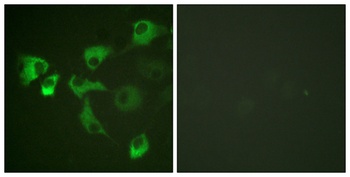 EF-2 (phospho Thr56) rabbit pAb