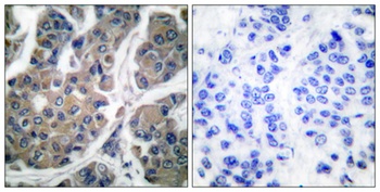 EF-2 (phospho Thr56) rabbit pAb