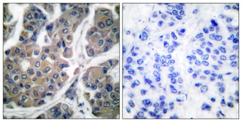 EF-2 (phospho-Thr56) antibody