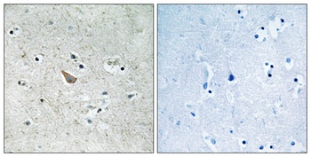 Ephrin-B1/2 (phospho-Tyr329) antibody