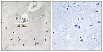 Ephrin-B1/2/3 (phospho Tyr324) rabbit pAb