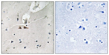 Ephrin-B1/2/3 (phospho-Tyr324) antibody